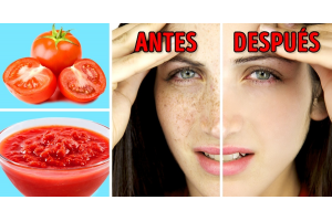 Los útiles consejos para deshacerte de las manchas solares en la piel con remedios naturales